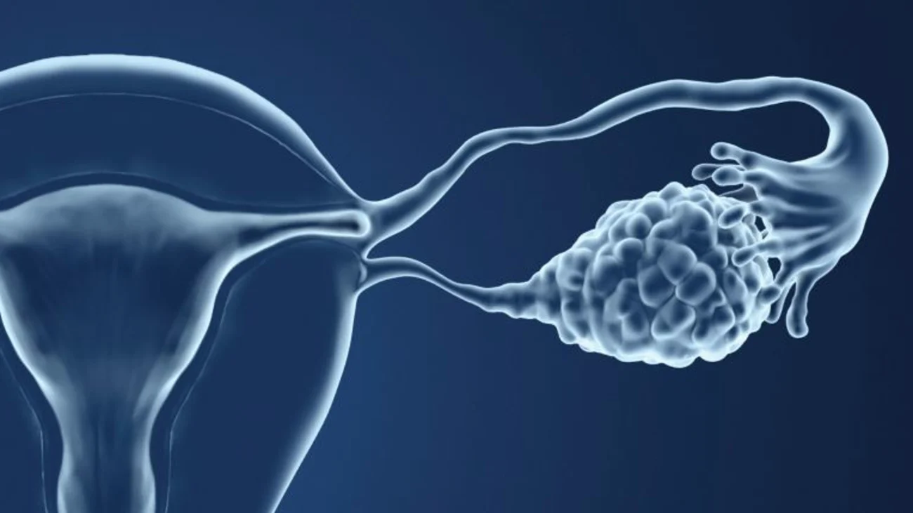 Breaking Barriers: Dr. Scott Kamelle, MD’s Impact on Gynecologic Neoplasm Treatment
